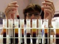 Ensoli: senza vaccino antiAids, solo i condom - Vaccino 14 - Gay.it Archivio