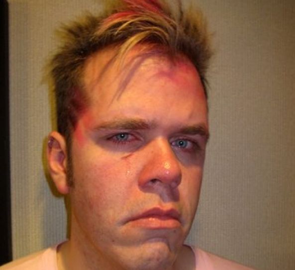 Perez Hilton preso a pugni dai Black Eyed Peas chiede aiuto su Twitter - Perezhiltonkick - Gay.it Archivio