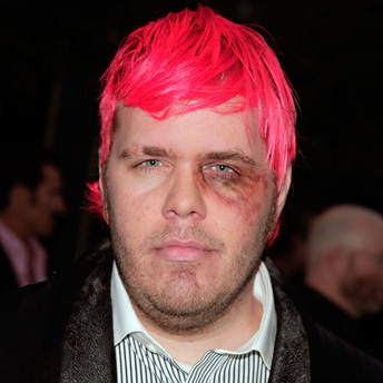 Perez Hilton preso a pugni dai Black Eyed Peas chiede aiuto su Twitter - Perezhiltonkick1 - Gay.it Archivio