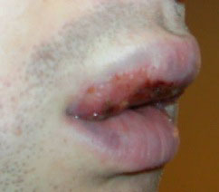 Roma: coppia aggredita a pochi giorni dal Pride - aggreditiromaprideF4 - Gay.it Archivio