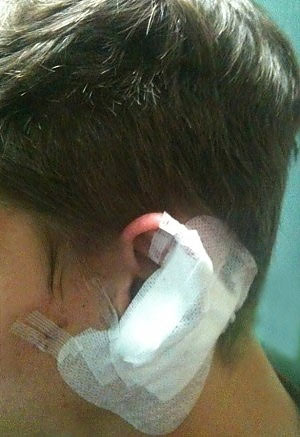Giovane gay aggredito a Roma a colpi di bicchiere - aggressione capodannoF1 - Gay.it Archivio