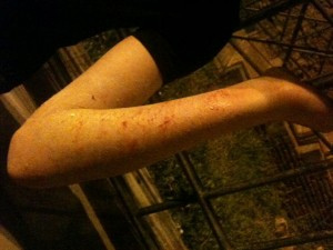 Denunciati aggressori di Reggio Calabria, violenza a Roma - aggressione villa pamphiliF1 - Gay.it Archivio