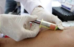 In Italia 150mila sieropositivi. 4mila contagi all'anno - aids nuovo cocktailF3 - Gay.it Archivio