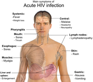In Italia 11 nuove infezioni ogni giorno - aidsinfection1 - Gay.it Archivio