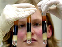 Risultati incoraggianti per il vaccino HIV italiano - ensolifase2BASE 1 - Gay.it Archivio
