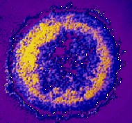 Aids: Montagnier preannuncia vaccino terapeutico - hiv virus - Gay.it Archivio