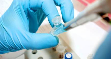 Ricercatori italiani: "a un passo dal cocktail che debella l'HIV" - hivoroF2 - Gay.it Archivio