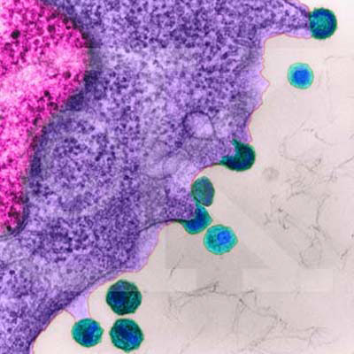 Scoperta nuova molecola, speranza per la cura dell'Aids - laboratorioaidsF2 - Gay.it Archivio