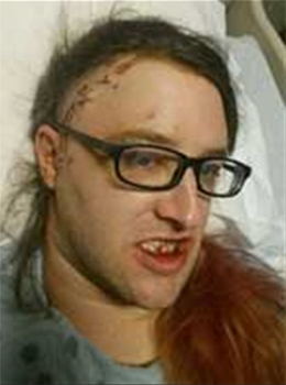 Aggressione ad una trans, ridotta in fin di vita - trans aggredita usa2 - Gay.it Archivio