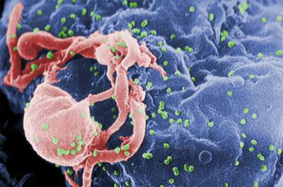 1 dicembre: dal 1982 a oggi 64mila casi di HIV - vaccinoaidsthaiF1 - Gay.it Archivio